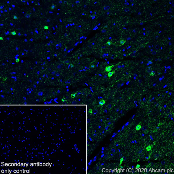 Immunohistochemistry (Frozen sections) - Anti-Homer1 antibody [EPR15309] (AB184955)
