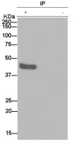 Immunoprecipitation - Anti-Homer1 antibody [EPR15309] (AB184955)