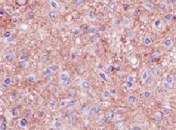 Immunohistochemistry (Formalin/PFA-fixed paraffin-embedded sections) - Anti-Homer1 antibody [EPR15309] - BSA and Azide free (AB232668), expandable thumbnail