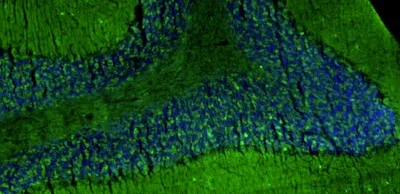 Immunohistochemistry (Formalin/PFA-fixed paraffin-embedded sections) - Anti-Homer1 antibody [L113/130] - Chicken IgY (Chimeric) (AB325659)