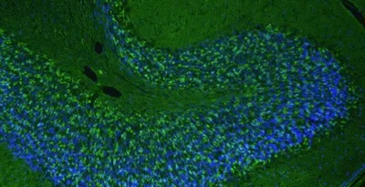 Immunohistochemistry (Formalin/PFA-fixed paraffin-embedded sections) - Anti-Homer1 antibody [L113/130] - Chicken IgY (Chimeric) (AB325659)