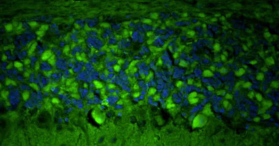 Immunohistochemistry (Formalin/PFA-fixed paraffin-embedded sections) - Anti-Homer1 antibody [L113/130] - Chicken IgY (Chimeric) (AB325659)