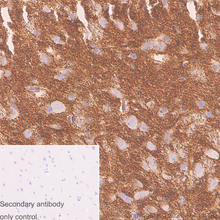Immunohistochemistry (Formalin/PFA-fixed paraffin-embedded sections) - Anti-Homer1 antibody [RM1121] (AB316287)