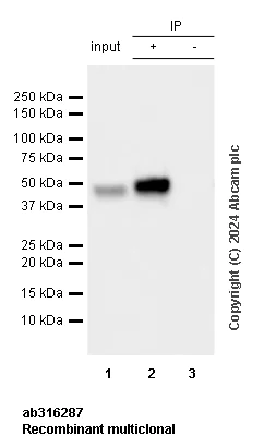 Immunoprecipitation - Anti-Homer1 antibody [RM1121] (AB316287)
