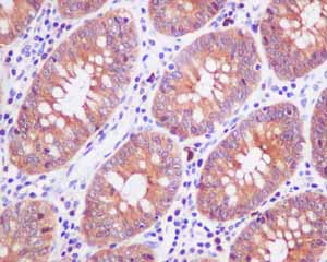 Immunohistochemistry (Formalin/PFA-fixed paraffin-embedded sections) - Anti-HOOK1 antibody [EPR10102] (AB151756), expandable thumbnail