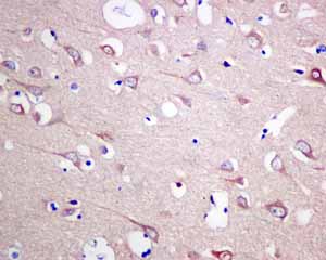 Immunohistochemistry (Formalin/PFA-fixed paraffin-embedded sections) - Anti-HOOK1 antibody [EPR10102] (AB151756), expandable thumbnail