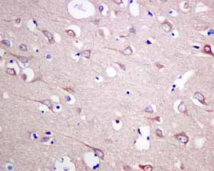 Immunohistochemistry (Formalin/PFA-fixed paraffin-embedded sections) - Anti-HOOK1 antibody [EPR10102] (AB151756)