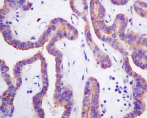 Immunohistochemistry (Formalin/PFA-fixed paraffin-embedded sections) - Anti-HOOK1 antibody [EPR10102] (ab151756), expandable thumbnail