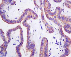 Immunohistochemistry (Formalin/PFA-fixed paraffin-embedded sections) - Anti-HOOK1 antibody [EPR10102] (AB151756)