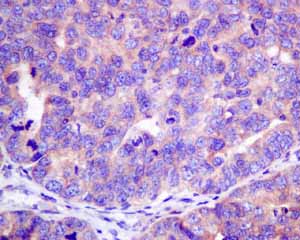 Immunohistochemistry (Formalin/PFA-fixed paraffin-embedded sections) - Anti-HOOK1 antibody [EPR10102] (ab151756), expandable thumbnail