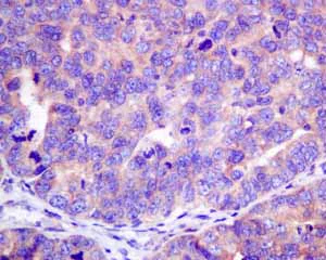 Immunohistochemistry (Formalin/PFA-fixed paraffin-embedded sections) - Anti-HOOK1 antibody [EPR10102] (AB151756)