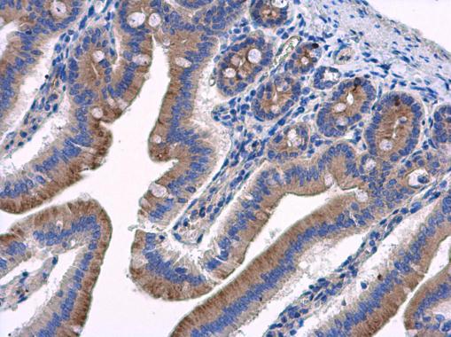 Immunohistochemistry (Formalin/PFA-fixed paraffin-embedded sections) - Anti-HOOK2 antibody (AB154109), expandable thumbnail