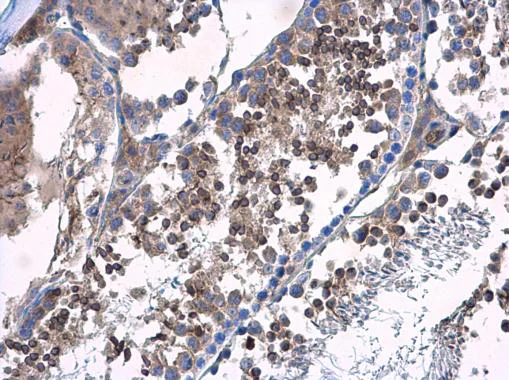 Immunohistochemistry (Formalin/PFA-fixed paraffin-embedded sections) - Anti-HOOK2 antibody (AB154109)