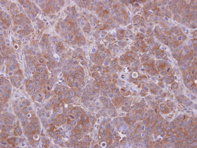 Immunohistochemistry (Formalin/PFA-fixed paraffin-embedded sections) - Anti-HOOK2 antibody (ab154109), expandable thumbnail