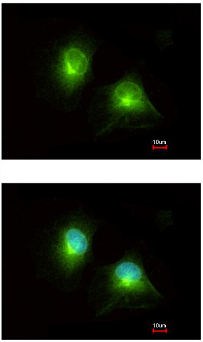 Immunohistochemistry (Formalin/PFA-fixed paraffin-embedded sections) - Anti-HOOK2 antibody (ab154109), expandable thumbnail