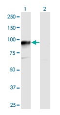 Western blot - Anti-HOOK3 antibody (AB173388)