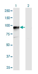 Western blot - Anti-HOOK3 antibody (AB173388)