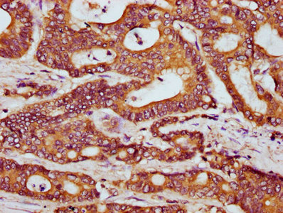 Immunohistochemistry (Formalin/PFA-fixed paraffin-embedded sections) - Anti-HOOK3 antibody (AB237529)