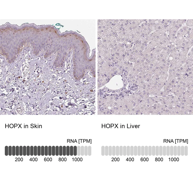 Immunohistochemistry (Formalin/PFA-fixed paraffin-embedded sections) - Anti-HOPX Antibody (AB327219)