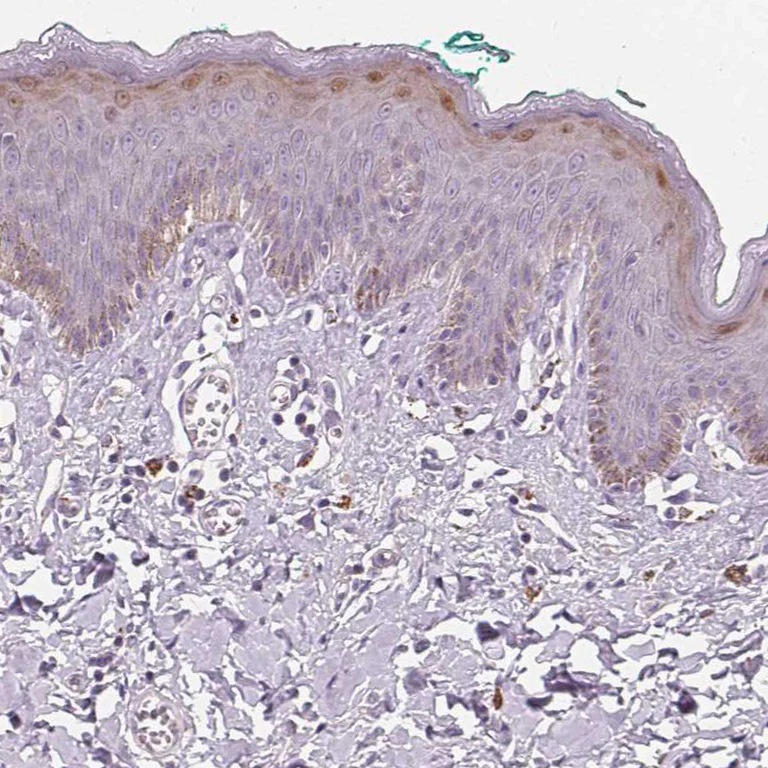 Immunohistochemistry (Formalin/PFA-fixed paraffin-embedded sections) - Anti-HOPX Antibody (AB327219)