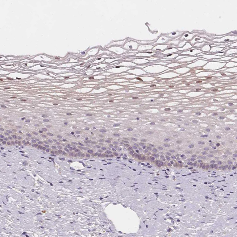 Immunohistochemistry (Formalin/PFA-fixed paraffin-embedded sections) - Anti-HOPX Antibody (AB327219)