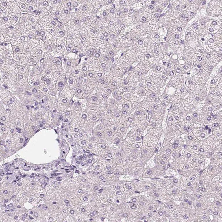 Immunohistochemistry (Formalin/PFA-fixed paraffin-embedded sections) - Anti-HOPX Antibody (AB327219)