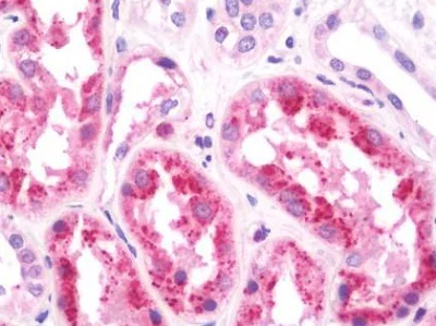 Immunohistochemistry (Formalin/PFA-fixed paraffin-embedded sections) - Anti-HOPX/HOD antibody (AB230544)