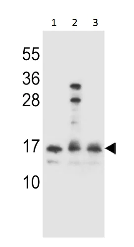 Western blot - Anti-HOPX/HOD antibody (AB230544)