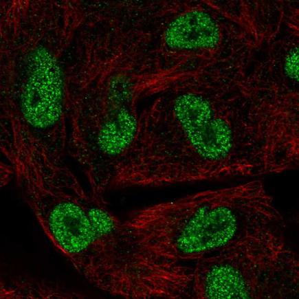 Immunocytochemistry/ Immunofluorescence - Anti-HORMAD1 antibody (AB220021), expandable thumbnail