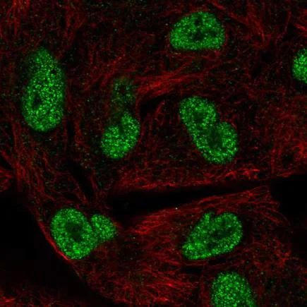 Immunocytochemistry/ Immunofluorescence - Anti-HORMAD1 antibody (AB220021)