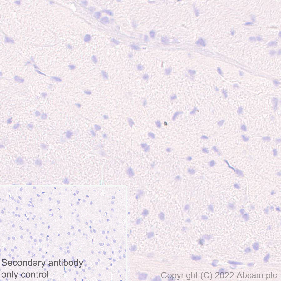 Immunohistochemistry (Formalin/PFA-fixed paraffin-embedded sections) - Anti-HORMAD1 antibody [EPR27316-24] (AB307424), expandable thumbnail