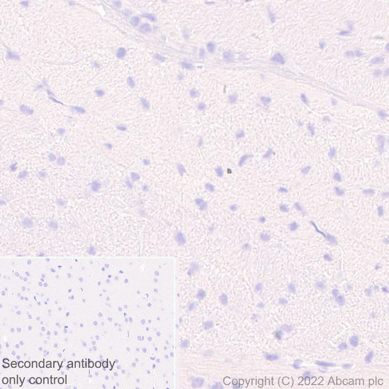Immunohistochemistry (Formalin/PFA-fixed paraffin-embedded sections) - Anti-HORMAD1 antibody [EPR27316-24] (AB307424)