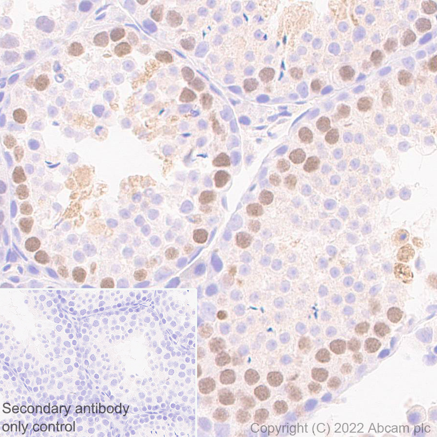 Immunohistochemistry (Formalin/PFA-fixed paraffin-embedded sections) - Anti-HORMAD1 antibody [EPR27316-24] (AB307424), expandable thumbnail