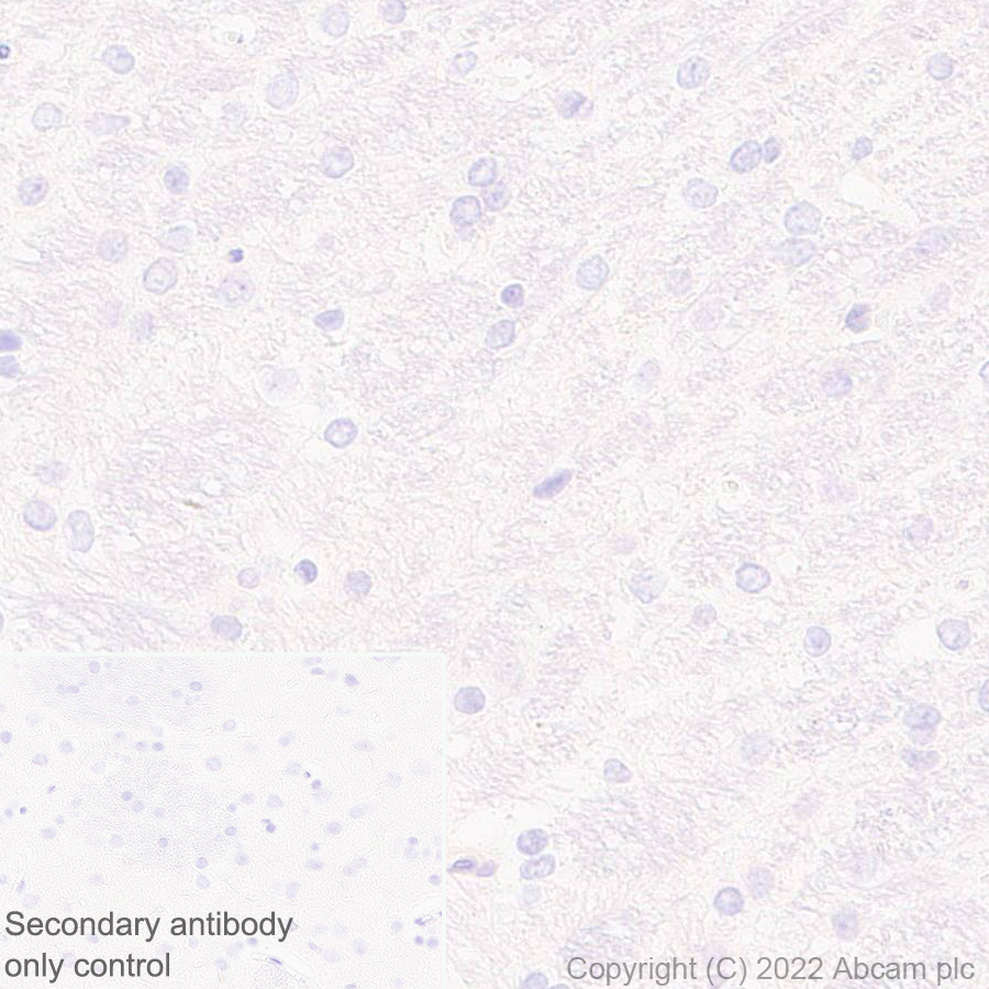 Immunohistochemistry (Formalin/PFA-fixed paraffin-embedded sections) - Anti-HORMAD1 antibody [EPR27316-24] (AB307424), expandable thumbnail