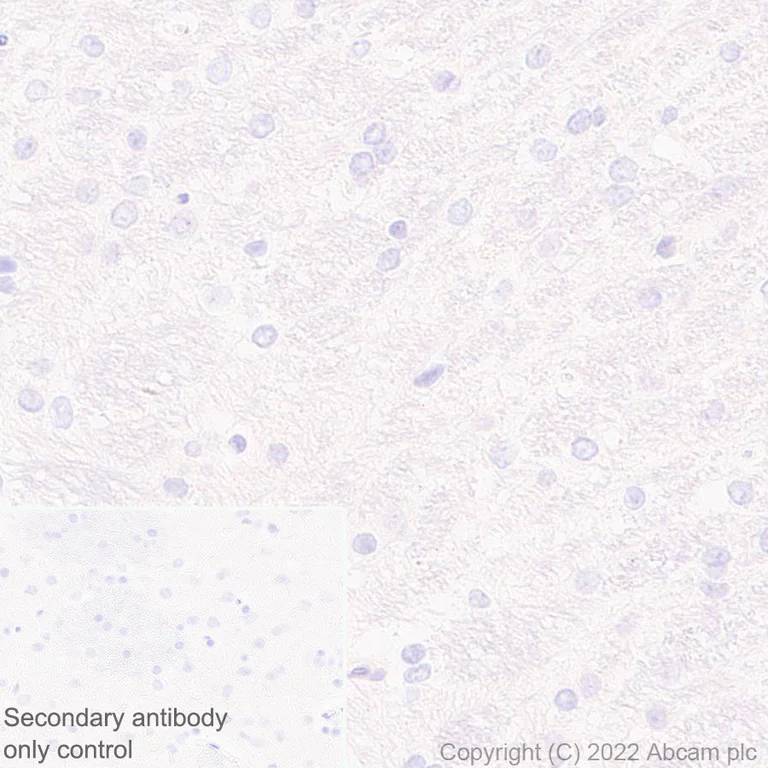 Immunohistochemistry (Formalin/PFA-fixed paraffin-embedded sections) - Anti-HORMAD1 antibody [EPR27316-24] (AB307424)