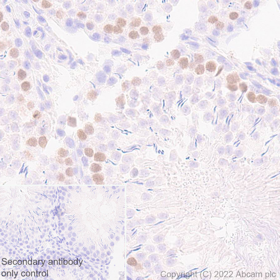 Immunohistochemistry (Formalin/PFA-fixed paraffin-embedded sections) - Anti-HORMAD1 antibody [EPR27316-24] (AB307424), expandable thumbnail