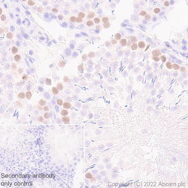 Immunohistochemistry (Formalin/PFA-fixed paraffin-embedded sections) - Anti-HORMAD1 antibody [EPR27316-24] (AB307424)