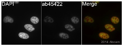 Immunocytochemistry/ Immunofluorescence - Anti-Hormone sensitive lipase/HSL antibody (AB45422)