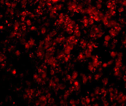 Immunocytochemistry/ Immunofluorescence - Anti-Hormone sensitive lipase/HSL antibody (AB45422)