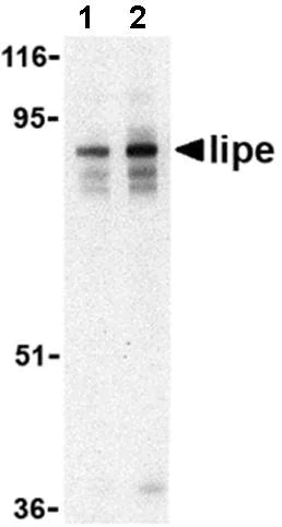 Western blot - Anti-Hormone sensitive lipase/HSL antibody (AB45422)