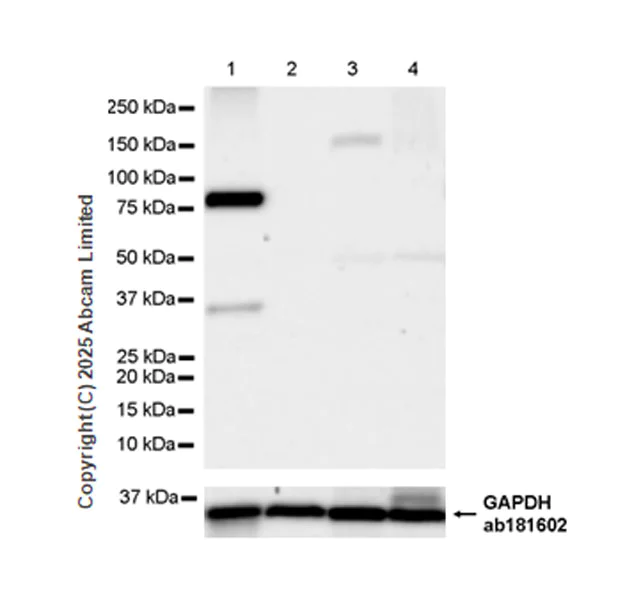 Western blot - Anti-Hormone sensitive lipase/HSL antibody [EPR27268-59] (AB325336)