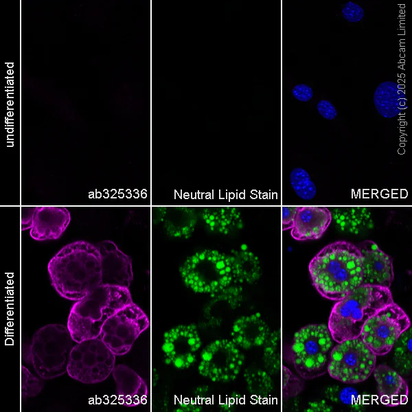 Immunocytochemistry/ Immunofluorescence - Anti-Hormone sensitive lipase/HSL antibody [EPR27268-59] - BSA and Azide free (AB325348)