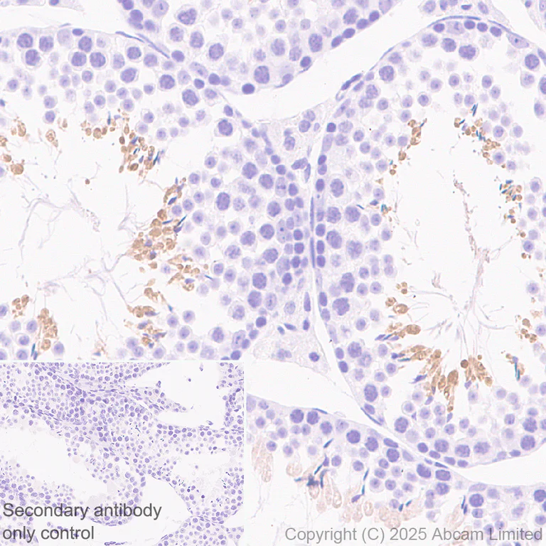 Immunohistochemistry (Formalin/PFA-fixed paraffin-embedded sections) - Anti-Hormone sensitive lipase/HSL antibody [EPR27268-59] - BSA and Azide free (AB325348)