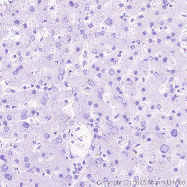 Immunohistochemistry (Formalin/PFA-fixed paraffin-embedded sections) - Anti-Hormone sensitive lipase/HSL antibody [EPR27268-59] - BSA and Azide free (AB325348)