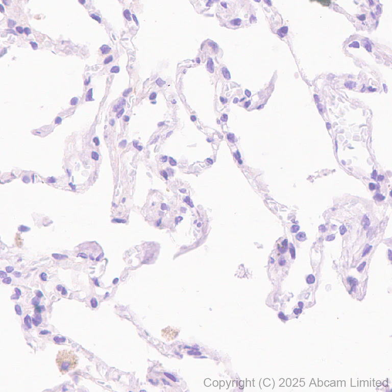 Immunohistochemistry (Formalin/PFA-fixed paraffin-embedded sections) - Anti-Hormone sensitive lipase/HSL antibody [EPR27268-59] - BSA and Azide free (AB325348)