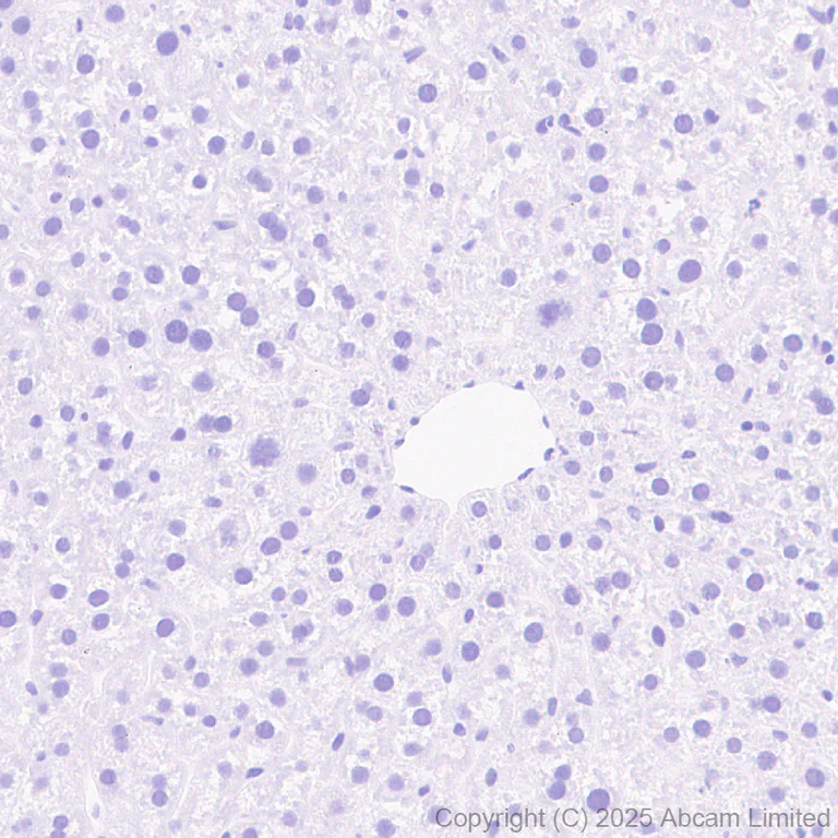 Immunohistochemistry (Formalin/PFA-fixed paraffin-embedded sections) - Anti-Hormone sensitive lipase/HSL antibody [EPR27268-59] - BSA and Azide free (AB325348)