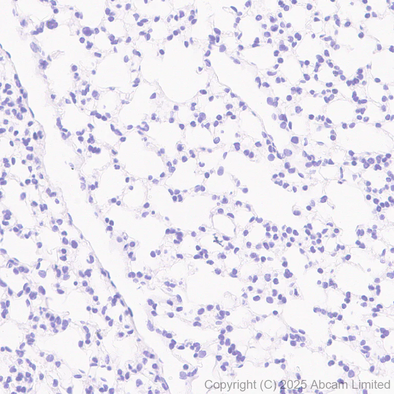 Immunohistochemistry (Formalin/PFA-fixed paraffin-embedded sections) - Anti-Hormone sensitive lipase/HSL antibody [EPR27268-59] - BSA and Azide free (AB325348)