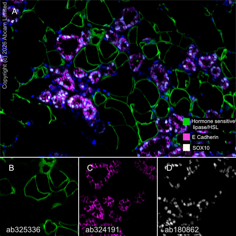 Multiplex immunohistochemistry - Anti-Hormone sensitive lipase/HSL antibody [EPR27268-59] - BSA and Azide free (AB325348)