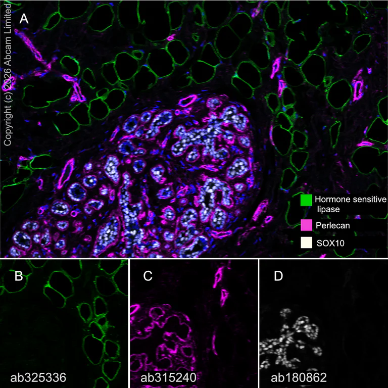 Multiplex immunohistochemistry - Anti-Hormone sensitive lipase/HSL antibody [EPR27268-59] - BSA and Azide free (AB325348)