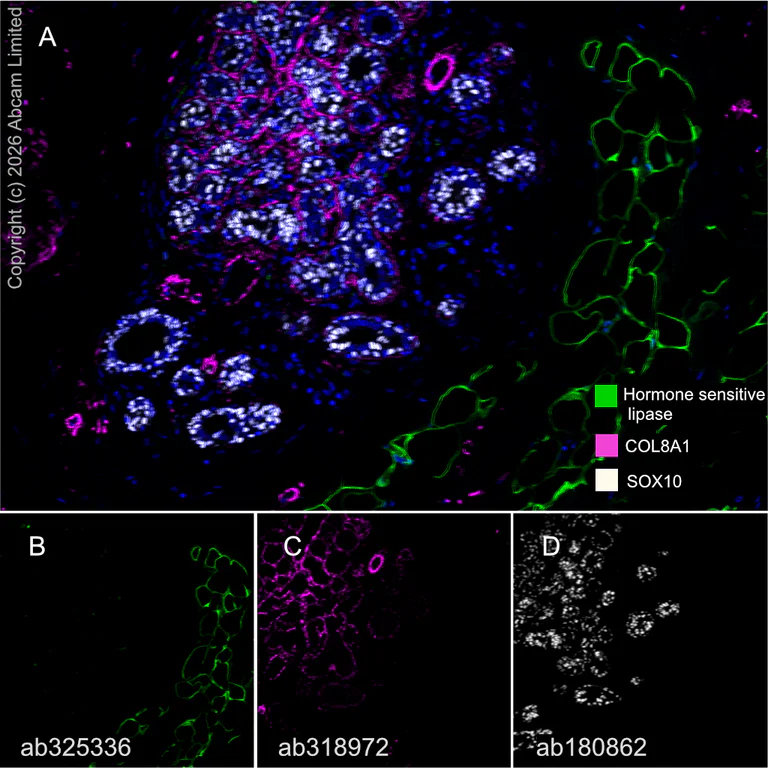 Multiplex immunohistochemistry - Anti-Hormone sensitive lipase/HSL antibody [EPR27268-59] - BSA and Azide free (AB325348)